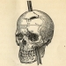 PhineasGage