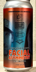 Facial Asymmetry